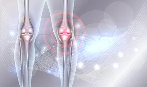 Joint treatment abstract background Stock Illustration