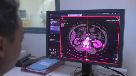 June 2016. CT or CAT scan at Medical University hospital HCMC Vietnam Stock Footage 127570612