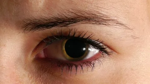 Junkies dilated pupil Video stock 12299635