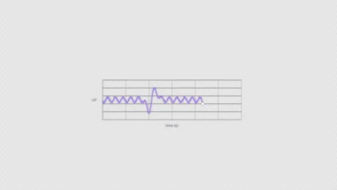 K Complex EEG Brain Wave Animation Clean No Text Video Overlay Alpha 4K Vidéo 339303742