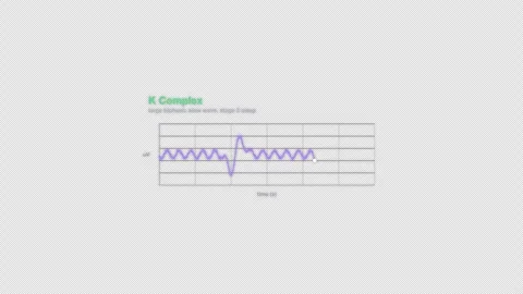 K Complex EEG Brain Wave Animation Labeled Video Overlay Alpha 4K Vídeos de archivo 339303745