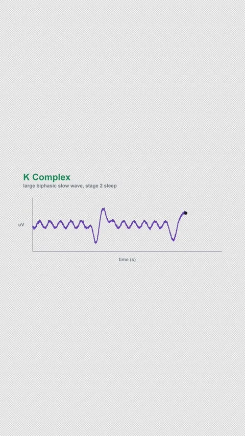 K Complex Labeled EEG Brain Wave Alpha 4K Vertical 9x16 Light Stockbeeldmateriaal 339493943