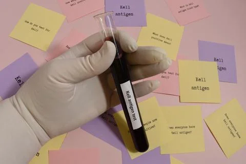 Kell antigen Stock Photos