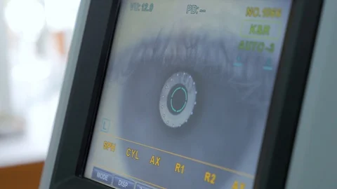 Keratometer - modern automated machine examining eyeball. Stock Footage 104753920