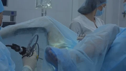 Keyhole surgery with endoscope. Video stock 93998566
