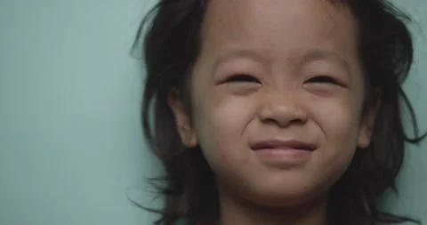 Kid face mosquito allergy Stock Footage 168976378