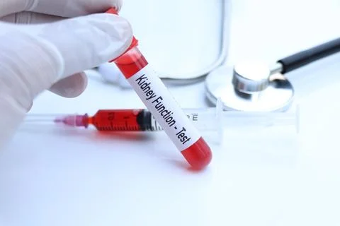 Kidney function test to look for abnormalities from blood Stock Photos