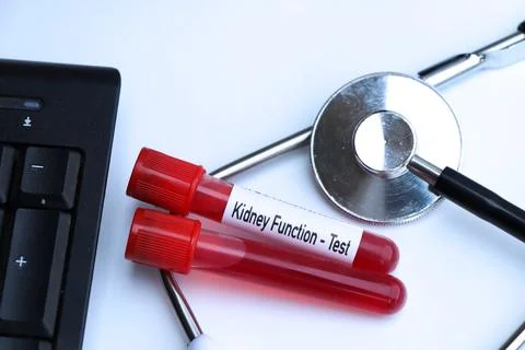 Kidney function test to look for abnormalities from blood Stock Photos