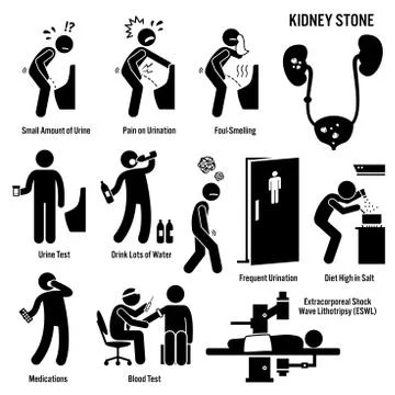 Kidney Stone Icons. Stock Illustration