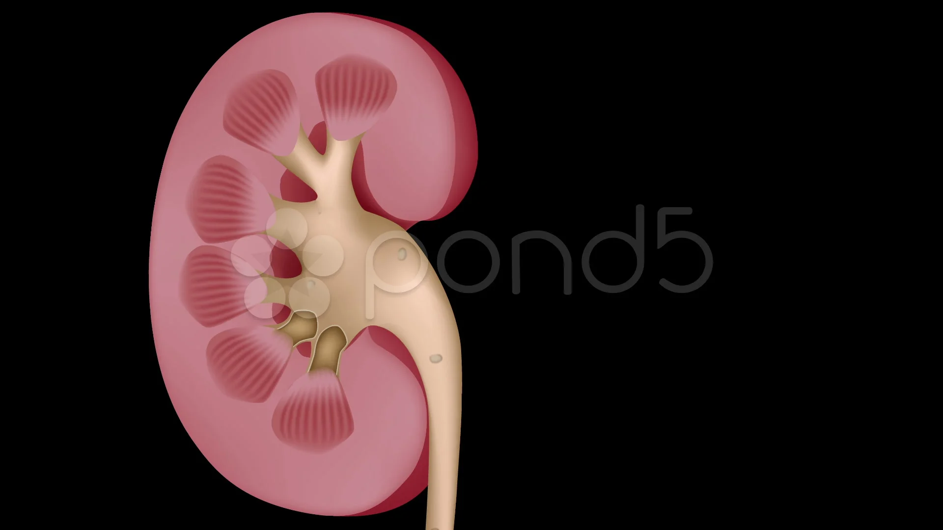 Kidney stones disease and treatment | Stock Video | Pond5