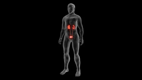 Kidney Stones 動画素材 121570334