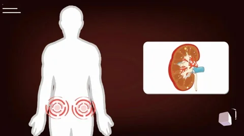 Kidney - vector animation - analysis - red Stock Footage 60398288