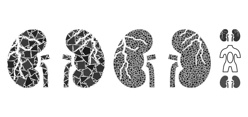 Kidneys cancer Composition Icon of Bumpy Elements Stock Illustration