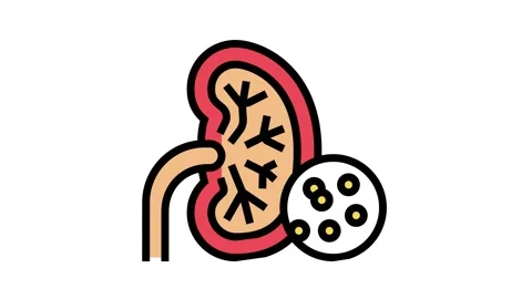 Kidneys problem color icon animation Stock Footage 163708917
