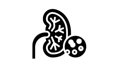 Kidneys problem glyph icon animation Stock Footage 163736701