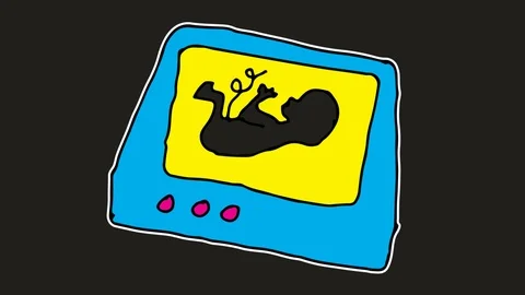 Kids drawing black screen with theme of ultrasound Stock Footage 105010880