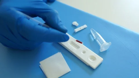Kit for carrying out express diagnostics on coronovirus covid-19. Mixing a blood Stock Footage 129030129
