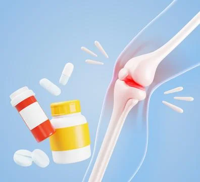 Knee anatomy 3D model with pill bottles, tablets, medicine drugs for Stock Illustration