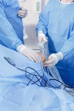 Knee Arthroscopy Procedure with Surgical Tools in Operating Room Stock Photos