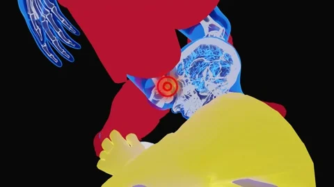 Knee Impact to the Head Causing Concussion – Sports Injury Visualization Video stock 342089077