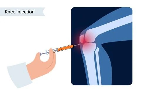 Knee Injection concept Stock Illustration