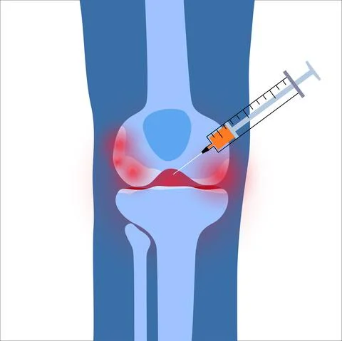 Knee Injection concept Stock Illustration