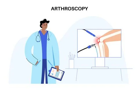 Knee joint arthroscopy Stock Illustration