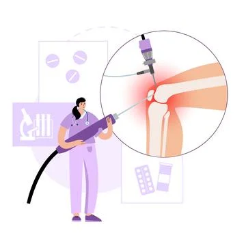 Knee joint arthroscopy Stock Illustration