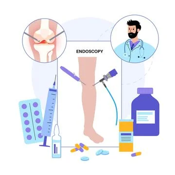 Knee joint arthroscopy Stock Illustration