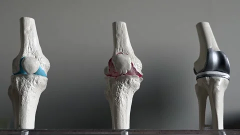Knee joint mockup Video stock 144633975