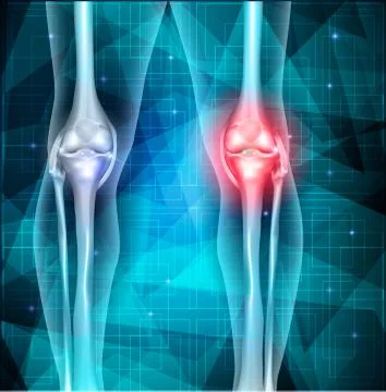 Knee joint pain abstract design Stock Illustration