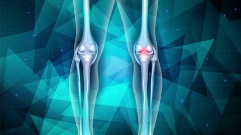 Knee joint pain beautiful abstract design, geometric figures Stock Footage 70987392