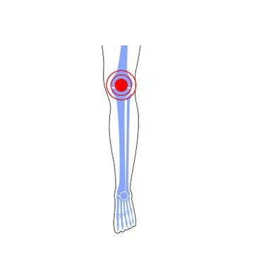Knee joint pain Illustrazione stock