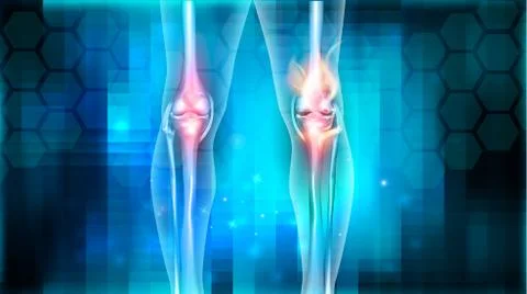 Knee joint problems Stock Illustration