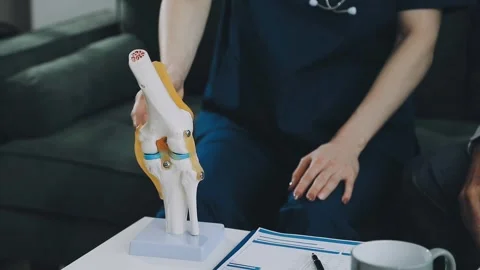 Knee model showing the process of osteoarthritis and knee arthroplasty, doc.. Stock Footage 314212316