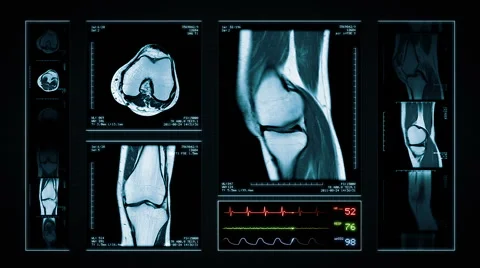 Knee MRI Scan. Blue. 4 in 1. Stock Footage