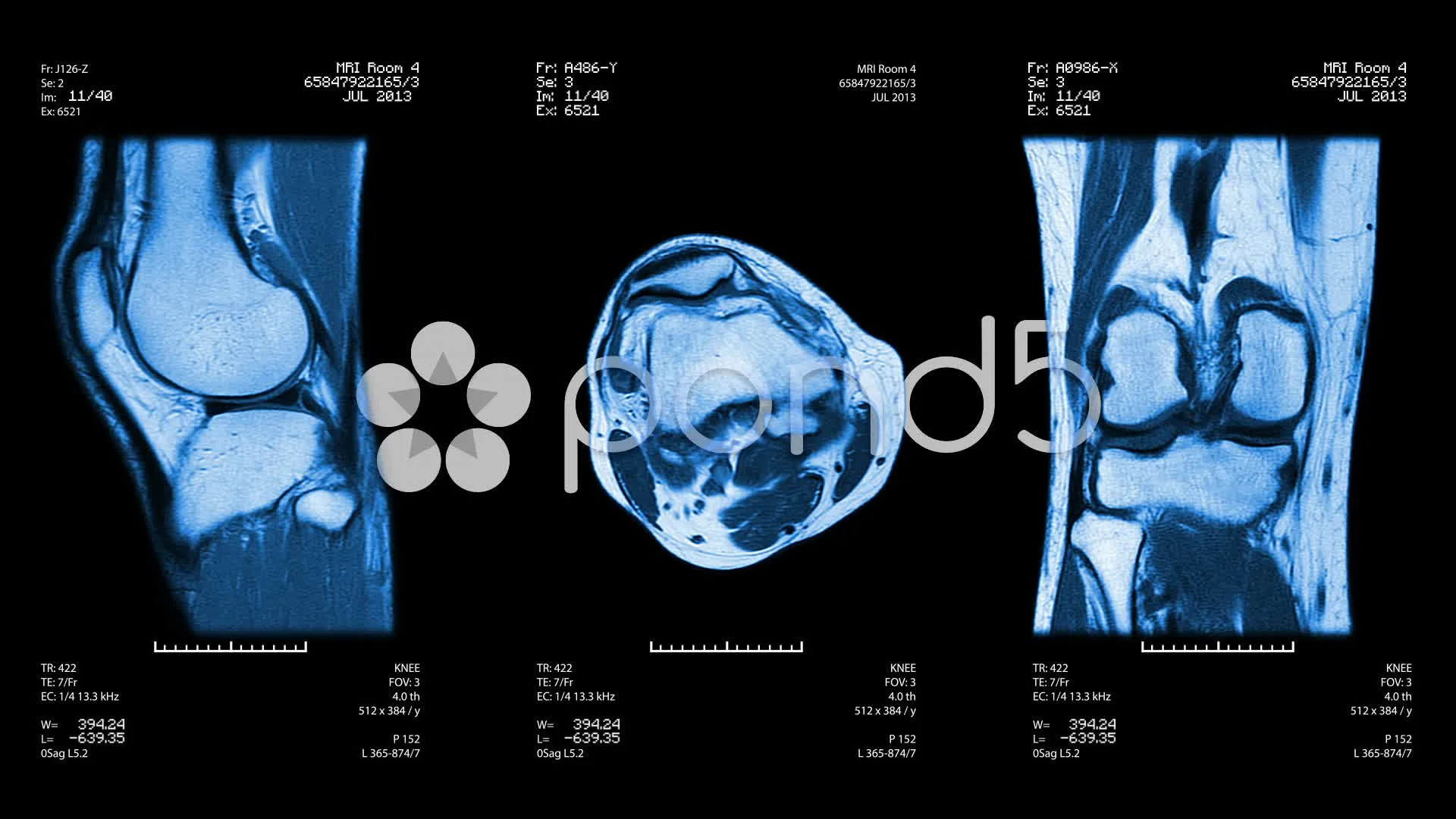 Mri Stock Video Footage Royalty Free Mri Videos Pond5 Mri Stock Video Footage Royalty Free Mri Videos Pond5