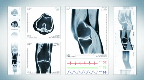 Knee MRI Scan. White. 4 in 1. Video stock 54837136