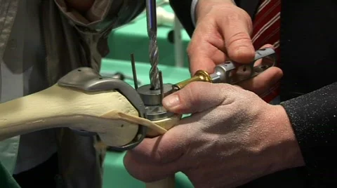 Knee Operation Demonstration Stock Footage 718420