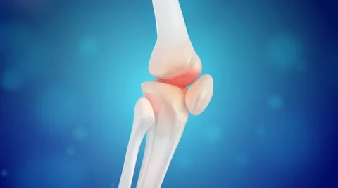 Knee Pain Animation Stock Footage 24844816