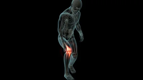 Knee Pain 스톡 동영상 121791709