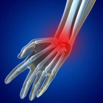 Knee pain Stock Illustration