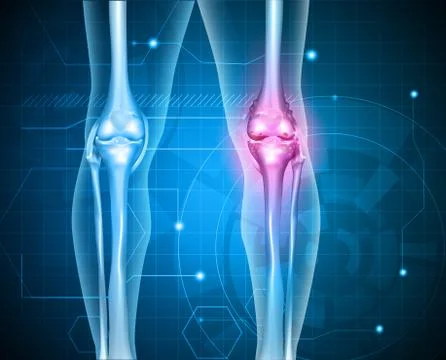 Knee pain Illustrazione stock