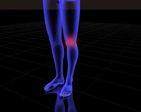 Knee pain Stock Illustration