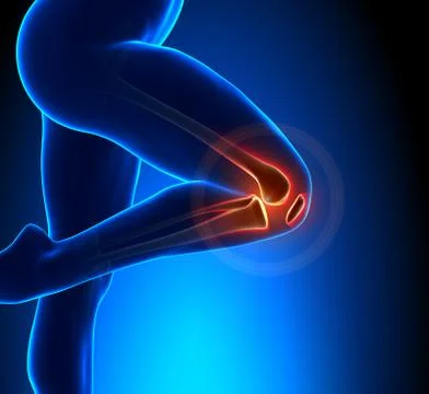 Knee Pain Superior View Stock Illustration
