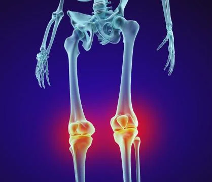 Knee problem. Xray view. Medically accurate 3D illustration Stock Illustration