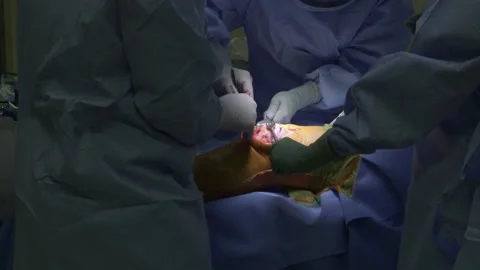 Knee Surgery 1 Stock Footage 140942502