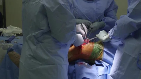 Knee Surgery 2 Stock Footage 140942503