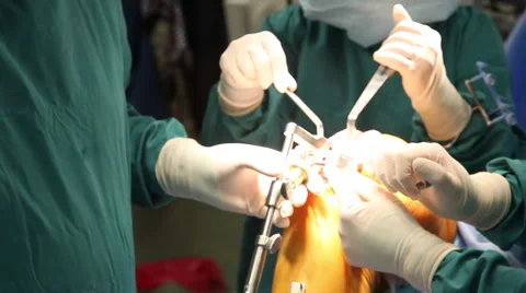 Knee Surgery 4 Vídeo Stock 55531445