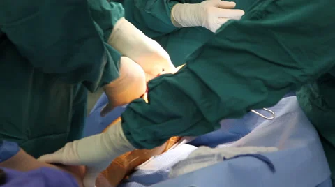 Knee Surgery 5 Vídeo Stock 55531430